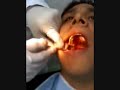El dentista loko (video sangriento) jeje