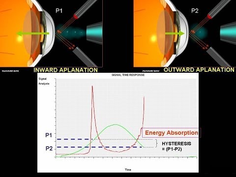 how to measure hysteresis