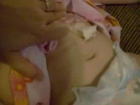 how to vent a mickey button