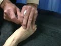 Japanese Acupuncture  Relieves Severe Flu Symptoms  Influenza Acupuncture