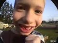 Niño se arranca diente utilizando un cohete