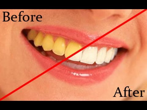 how to whiten teeth in photoshop cs5