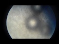 semen under the microscope