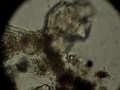 rotifer Dissotrocha spinosa