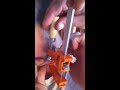 Ingrown hair