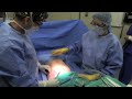 Plastic Surgery:Tummy Tuck Abdominoplasty Surgery