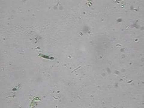 Chromatium - A Purple Sulfur Rotten ...