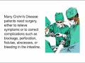 Crohn\
