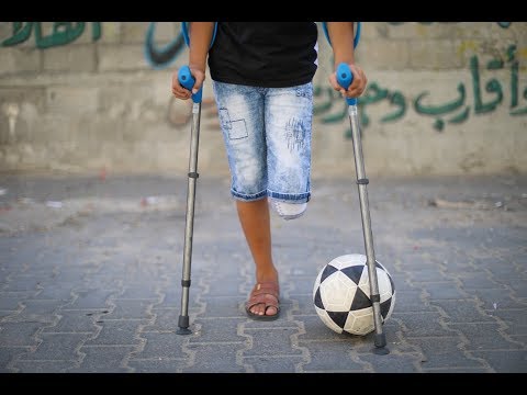 Gaza boy fitted for prosthetic leg in Ohio