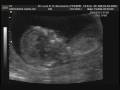 4� consulta � 1� ultra morfol�gico