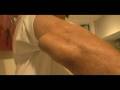 Skateboarding-Injury