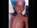 The Starving Chlidren of Africa