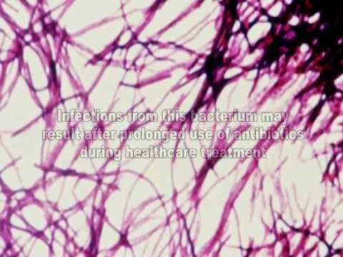 Clostridium difficile: Community and Healthcare Associated Infections

