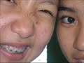 II-Evans