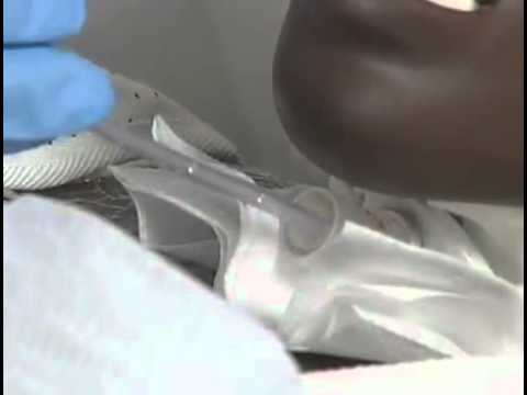 how to provide tracheostomy care