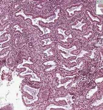 endometrium - Shotgun Histology Secretory Endometrium.