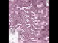 Shotgun Histology Secretory Endometrium
