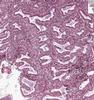 Shotgun Histology Secretory Endometrium