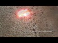 Laser Acne Scar Removal Treatment - Hispanic Patient