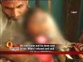 Jaipur minor burnt for resisting molester
