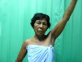 Rotator cuff tear atrophy weakness ?????????????? ??????????? ?????????? ??????????????? Rotator cuff tear atrophy weakness ?????????????? ??????????? ?????????? ???????????????