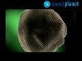 Un hallazgo permite disminuir las dosis de quimioterapia