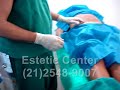 LipoLaser - Lipo laser - Gordura - Estetic Center