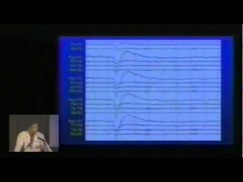 Year 2001 Epilepsy Workshop for Health Care Professionals April4, 2001 Tape 1 2