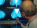 B4x3N FILE MAMMOGRAMS STUDY RECOMMENDS AGAINST ANNUAL SC HE 148MO CNNA ST1 1000000000056031 100 0