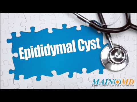 how to cure epididymal cyst