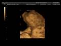 4d scan of my twins