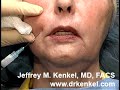 www.drkenkel
