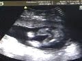 mi bb  ; )  - ade y armando