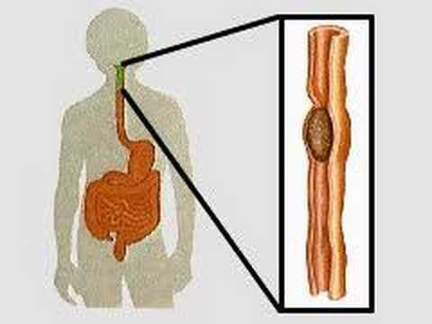 How the Body Works : The Alimentary ...
