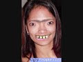 Strange and Ugle People
