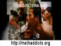 Crystal Meth Addicts - Get Help Today!