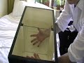 Mirror Box and Phantom Limb Pain #1