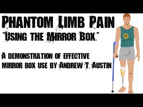 how to treat phantom limb pain