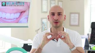 Melih Özgen-5