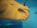 Doctor Fish