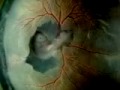 Evolution Genetics Embryo's and our Common Ancestor's