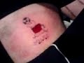 burbidge tattoo