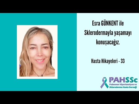 Hasta Hikayeleri - Esra GÜNKENT ile Sklerodermayla Yaşamak - 33 - 2021.04.06
