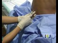 Anestesia epidural para el parto. Creado por el Hospital Universitario de Guadalajara (España)