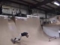 Skate Unfälle