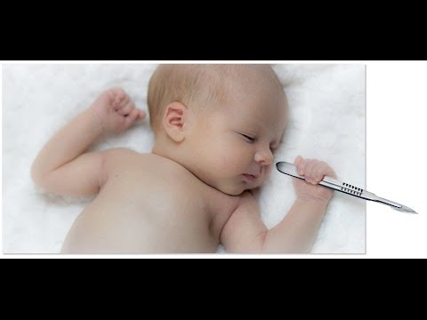 كيف اعتني بجرح الولادة القيصرية