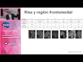 Neurology up to Date 2015 Rafael Toledano Neurology up to Date 2015 Rafael Toledano