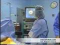 ny plastic surgery Dr Vitolo transumbilical breast augmentation video