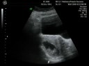 Nuestro BeBe
