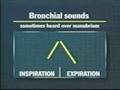 Breath Sounds